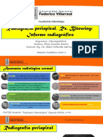 RX Periapical, RX Bitewing - Informe Rx-Perez Gonzales Eveline