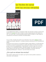 SALUD-10 Maneras Fáciles de Sanar Naturalmente Las Encías Retraídas