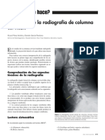 Cómo Se Lee Una RX Cervical