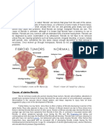 Myoma Uteri: Pregnancy Puberty