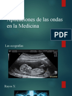 Aplicaciones de Las Ondas en La Medicina