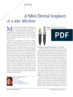 Product Focus: The Hybrid Mini Dental Implant: A Case Review