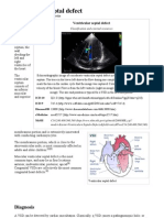 Ventricular Septal Defect