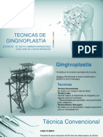 Tecnicas de Gingivoplastia - Casos Clínicos