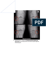 Lower Extremity Conditions Part 4 NPTE FF LSP