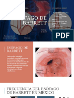 Esófago de Barrett