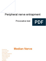 Pronator Teres Syndrome