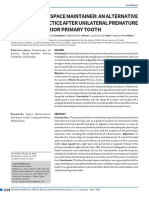 Direct Bonded Space Maintainer: An Alternative in Clinical Practice After Unilateral Premature Loss of Posterior Primary Tooth