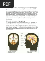 Cerebro Escindido.