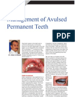 Management of Avulsed