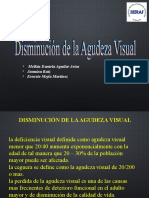 Disminución de La Agudeza Visual