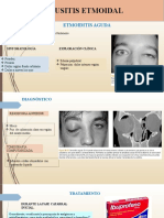 Diapositivas Sinusitis Etmoidal y Esfenoidal