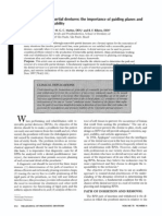 Surveying Removable Partial Dentures