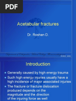 Acetabular Fractures