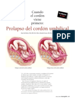 Prolapso Del Cordón Umbilical