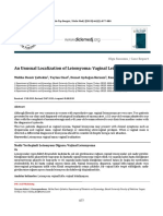 An Unusual Localization of Leiomyoma: Vaginal Leiomyoma