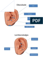 Protocolos de Auriculoterapia