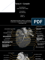 Imagenes Axiales de Corazón