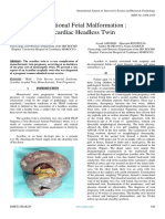 Exceptional Fetal Malformation Acardiac Headless Twin