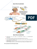 Multiple Sclerosis: Demyelination-Damages The Myelin Sheath and Neurons This Damage Slows Down or