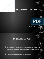 Ankylosing Spondylitis: - Arun - R