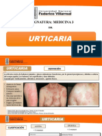 URTICARIA