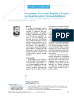 Terapia Interdisciplinar Expansão Rápida e Tração Da Maxila Com Acompanhamento Fonoaudiológico