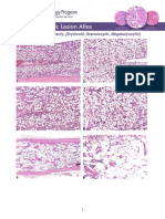 Bone Marrow-Hypocellularity 508