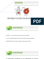 Enterocolitis Necrotizante Diapositivas