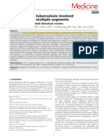 Atypical Spinal Tuberculosis Involved