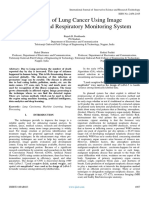 Detection of Lung Cancer Using Image Processing and Respiratory Monitoring System