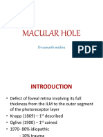 Macular Hole: DR Samarth Mishra