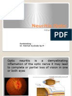 Neuritis Optic