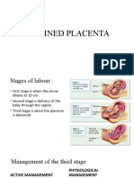 Retained Placenta