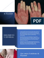 Diapositivas Enfermedad Raynaud