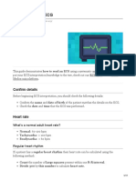 How To Read An ECG