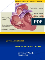 Mitral Valve