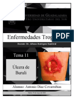 Tema 11. Úlcera de Buruli. ADC