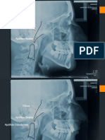 Cefalometria Dr. Armando