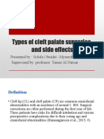 Types of Cleft Palate Surgeries and Side Effects