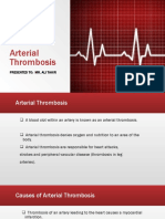 Arterial Thrombosis by Abrar