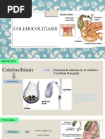 Coledocolitiasis Expo