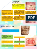 Oclusion Colapsada