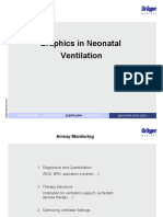 Understanding Ventilator Curves - Drager