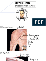 Upper Limb Cadaver