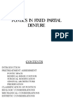 Pontics in Fixed Partial Denture