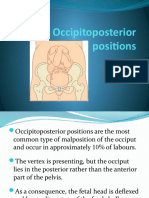 Occipitoposterior Positions