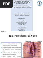 Patologia Tumoral Vulva 2 Final