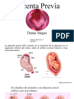 Placenta Previa 9