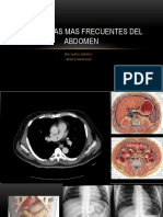 Clase 14 Patologías Frecuentes Del Abdomen (Apuntes) - Compressed